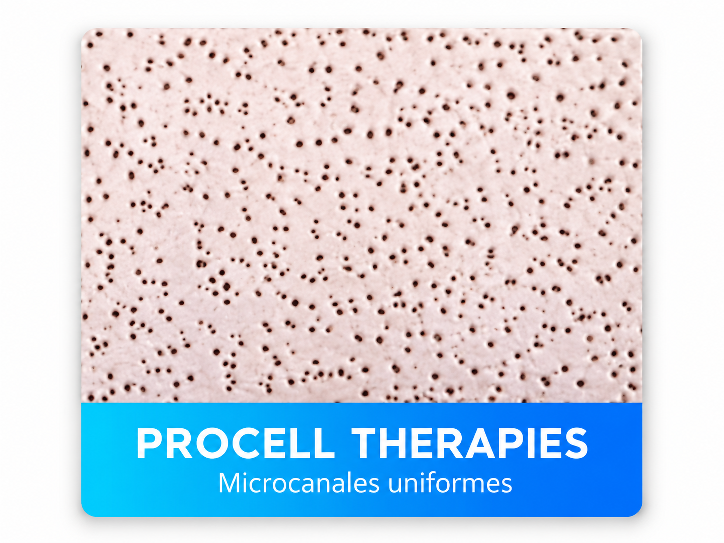 Procell Therapies: microcanales uniformes
